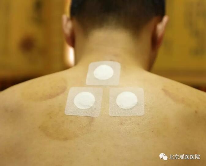 阳气足则百病消，夏季养阳正当时～(图2)
