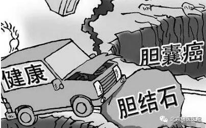 【科普】不要小看了“结石”，严重的还能诱发恶性肿瘤(图1)