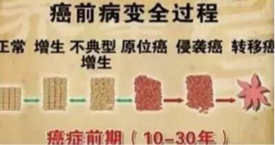 肿瘤来之前，都会有“瘤前病变”!很多人没重视(图2)