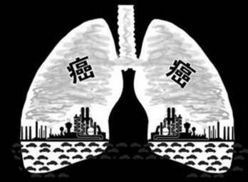 会呼吸的痛，哪些“痛”是肺肿瘤的报警器(图3)