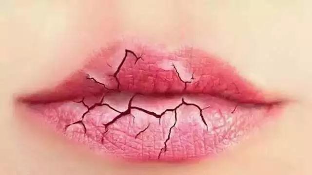 嘴唇是身体的晴雨表 观嘴唇知健康(图4)