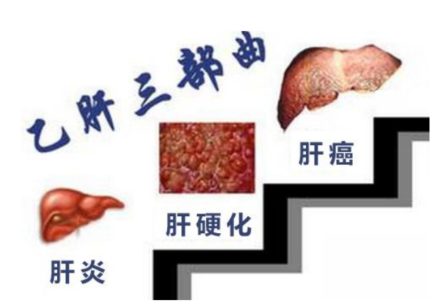 乙肝三部曲