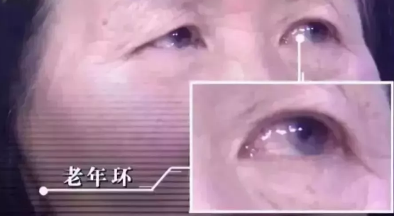 93岁院士说：这样做降脂溶栓护血管，可以少往可以少往医院(图4)