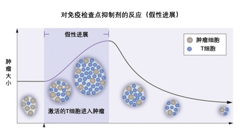 肿瘤增大都可能是骗人的？标志物升高也不一定恶化！(图3)