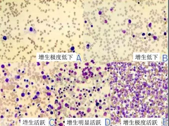 查出来“不典型增生”，只有傻等它“癌变”吗?(图2)