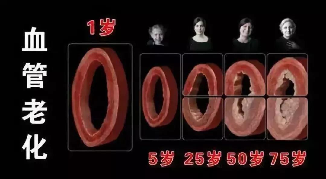 这根血管很怕堵,2个病变要点需注意,不妨给血管..(图3)