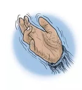 经常手“抖”需重视!(图4)