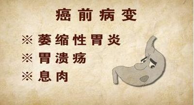 胃息肉:往前一步就是胃肿瘤!发现胃息肉,建议你这么做!(图3)