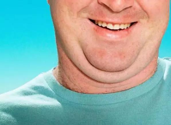 男人这超过39厘米，女人这超过35厘米，很危险!还有肿瘤...(图1)