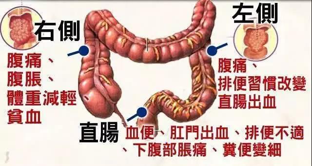 【揭秘】大便变细就是得了肠肿瘤?医生说:不一定,还有....(图3)