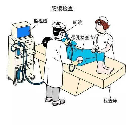 【揭秘】大便变细就是得了肠肿瘤?医生说:不一定,还有....(图4)