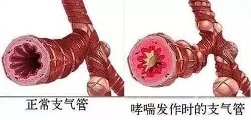 速效救心丸的最新用途! 99%的人不知道!(图3)