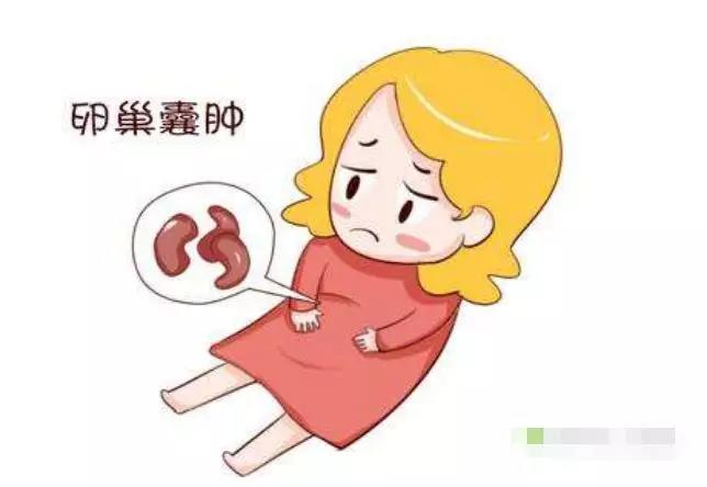 【警惕】女性黑眼圈,仅是变丑的节奏?当心卵巢囊肿才是真!(图2)