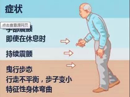 帕金森