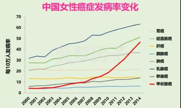 甲状腺癌