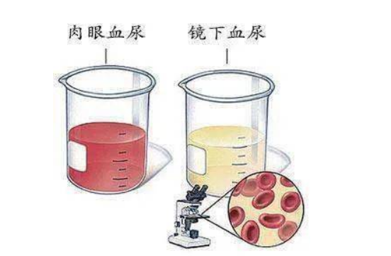 警惕!身体这7处“异常”出血,可能是“癌症” 来袭!(图4)