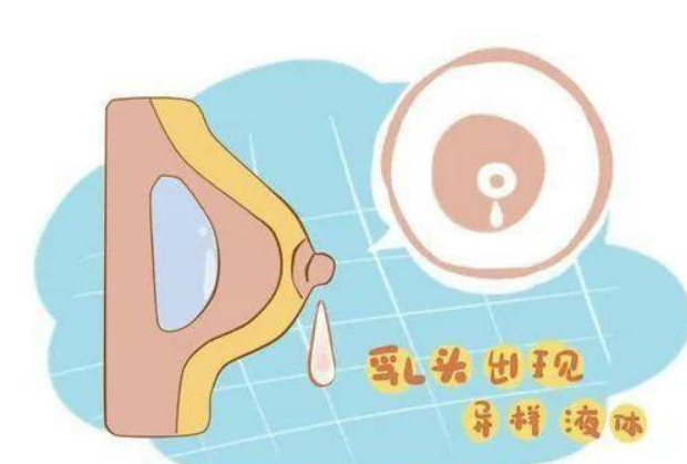 警惕!身体这7处“异常”出血,可能是“癌症” 来袭!(图5)