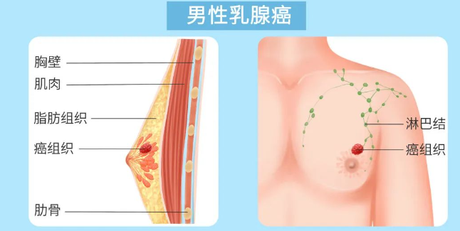 微信截图_20231114160036.png