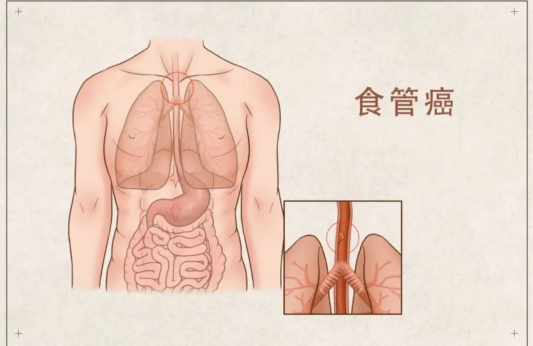 51c2b160c290ee3d8e1da4ae1489b8ff.jpg